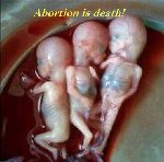 Thumb for abortiondeath.jpg (41 
KB)